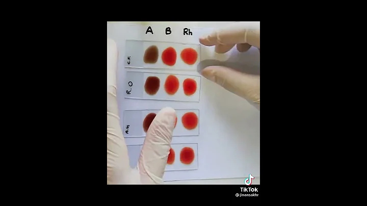 know your blood type - DayDayNews