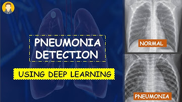 PNEUMONIA Detection Using Deep Learning in Tensorflow, Keras & Python | KNOWLEDGE DOCTOR |