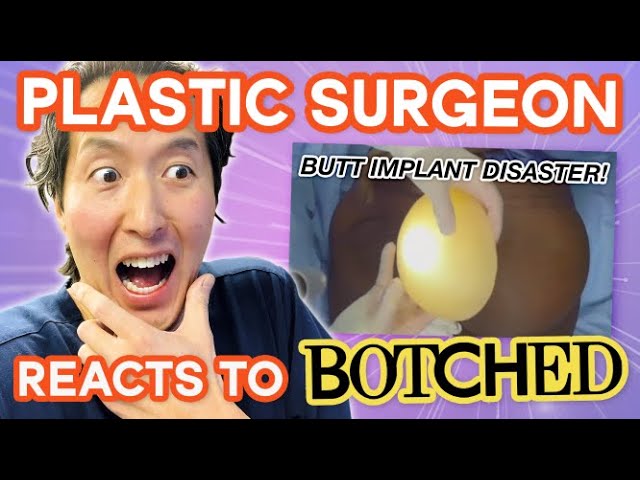 Plastic Surgeon Reacts to BOTCHED BY NATURE: HUGE, Droopy Breasts! 