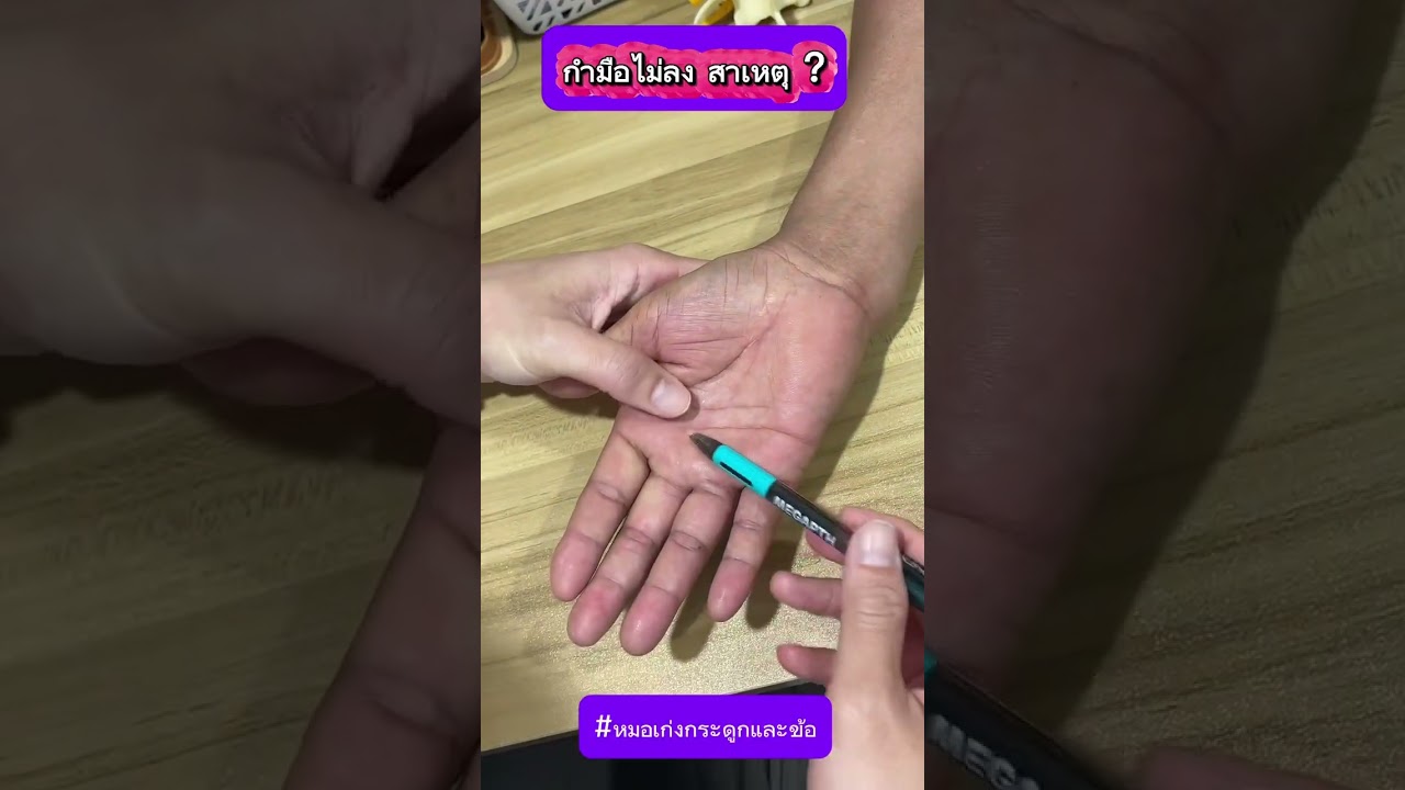 กำมือไม่ลง สาเหตุ ?
