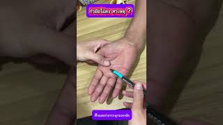 กำมือไม่ลง สาเหตุ ?