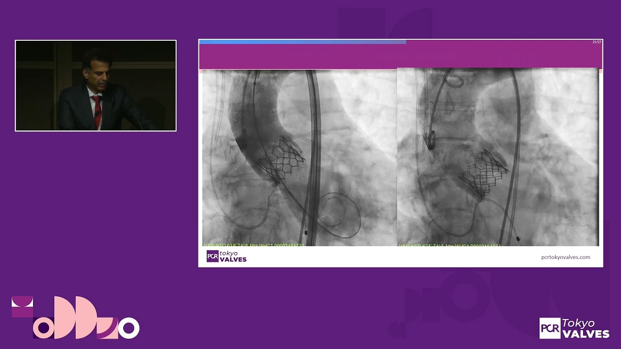 Built to last: lifetime management for durability and beyond - PCR Tokyo Valves 2026