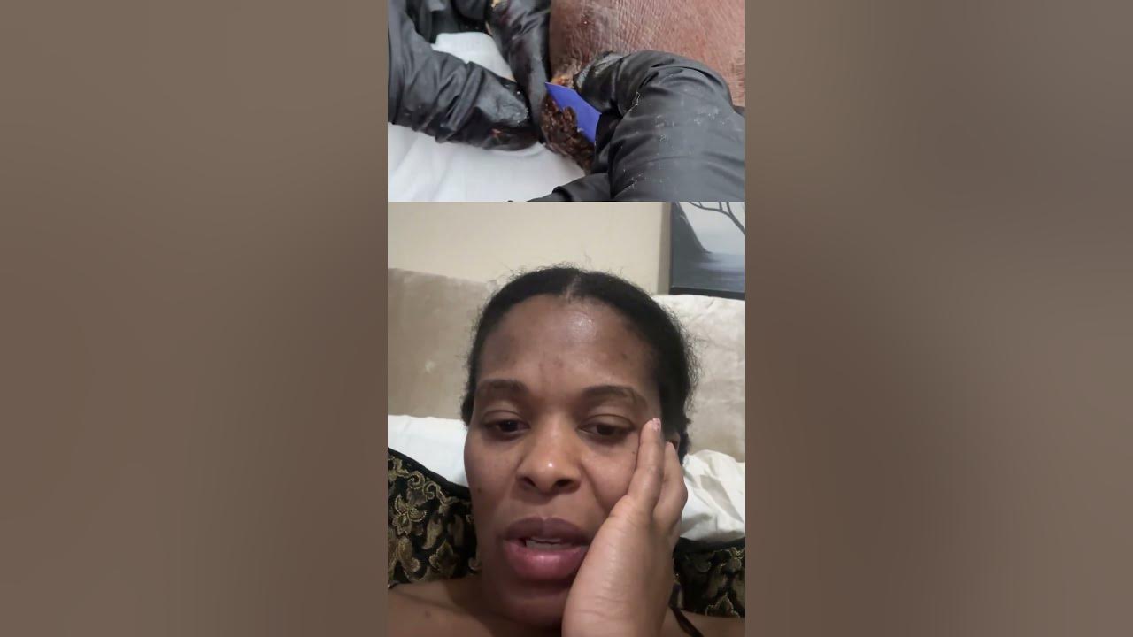 Why is Jiggers infestation so common? jiggers YouTube