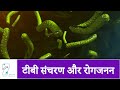 टीबी संक्रमण और रोकथाम