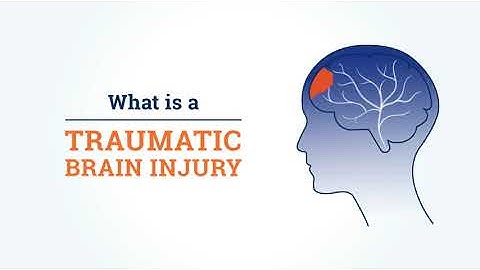 What is a traumatic brain injury? What are the 3 top causes of TBI?