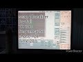 MRI | cervical spine Tuberculosis (TB) | Learning MRI 0.3 Tesla
