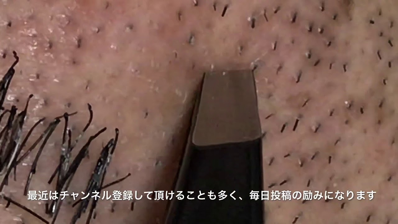 pull out the beard】ずっと見てられる信頼のヒゲ抜き 2018.4.22 - YouTube