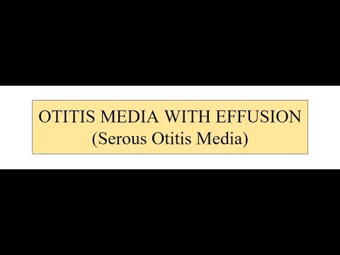 Video: Otitis Media With Effusion: Příčiny, Příznaky A Diagnostika