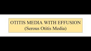 OTITIS MEDIA WITH EFFUSION