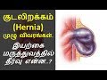 குடலிறக்கம் | வீட்டு மருத்துவம் என்ன? | Home remedies for hernia in tamil