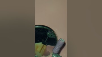 Problem solving with apex locators | Dentistry | Endodontics | Dr. Agam Bhatnagar | EEeducation.in