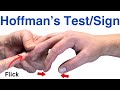 How to Perform a Hoffman