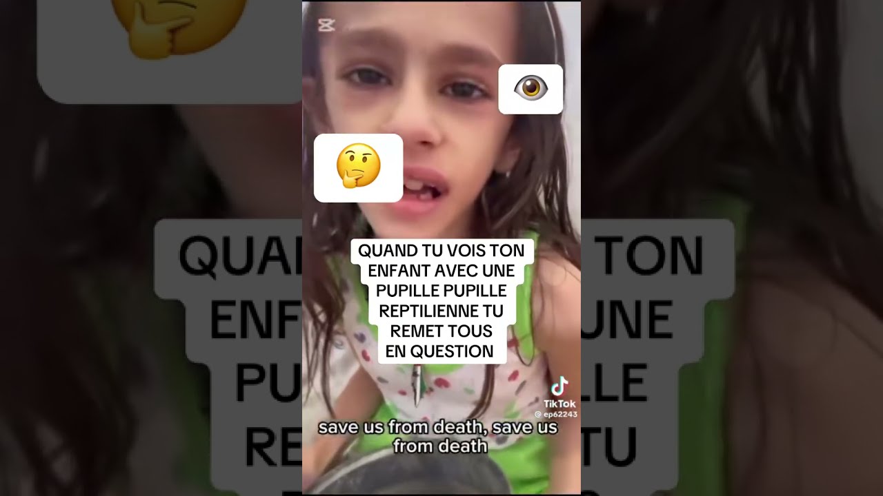 Quand Tu Vois Ton Enfant Avec Une Pupille Reptilienne Remet Tout En Question 