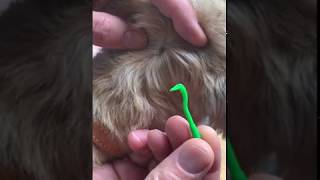 How to remove a tick