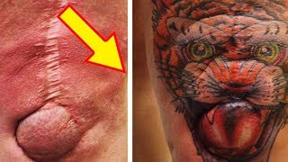 Wonderful Tattoos That Turn Scars Into Works Of Art