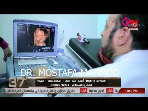 تصویری: والتر سونار بات: 29 قدم تصویری: والتر سونار بات: 29 قدم