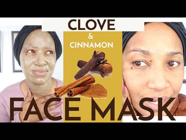CLOVE & CINNAMON FACE MASK REMOVES NATURALLY DARK SPOTS, SCARS AND BLEMISHES , TRY IT!!! class=