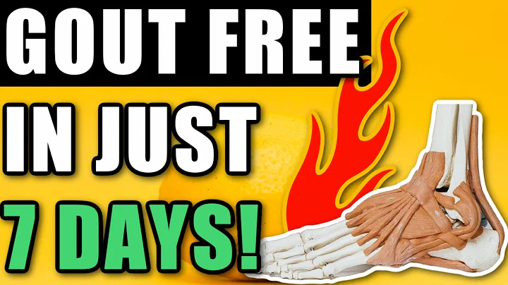 Detailed End Of Gout Review By Shelly Manning - Go...