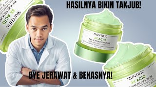 ATASI JERAWAT CEPAT DENGAN SKINTIFIC 3X ACID ANTI ACNE GEL MOISTURIZER UNTUK KULIT BERJERAWAT