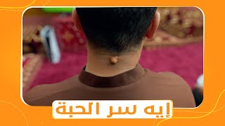 شباب البومب 11 | عامر اكتشف أن في حبة غريبة في رقبته يا ترى إيه السبب