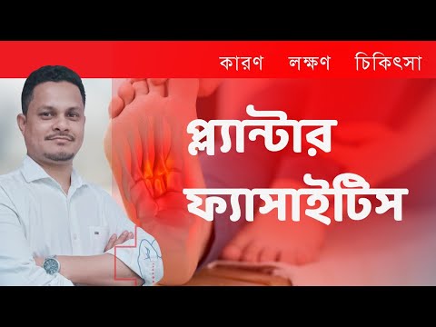 প্ল্যান্টার ফ্যাসাইটিস কারণ , লক্ষণ, চিকিৎসা | Discretion by Dr. Gazi Arif Velia Orthopedics #health