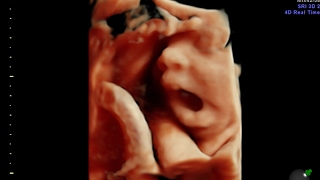 HD LIVE ULTRASOUND 4D! 30 WEEKS | WE FOUND OUT THE GENDER! | HUGE SURPRISE FOR TYLER