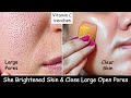Skin Brightening - Rub Vitamin C Ice cubes on Face to close Large Open Pores &amp; Skin Whitening