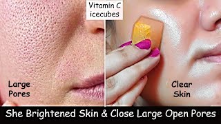 Skin Brightening - Rub Vitamin C Ice cubes on Face to close Large Open Pores &amp; Skin Whitening