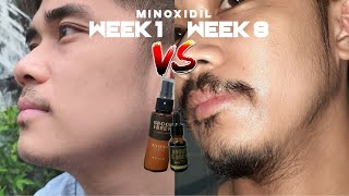 Minoxidil Beard Journey | 2nd Month | Week 1-8 (Groom & Brew) - Filipino
