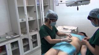 видео Операция по имплантации золотых нитей, коррекция лица золотыми нитями