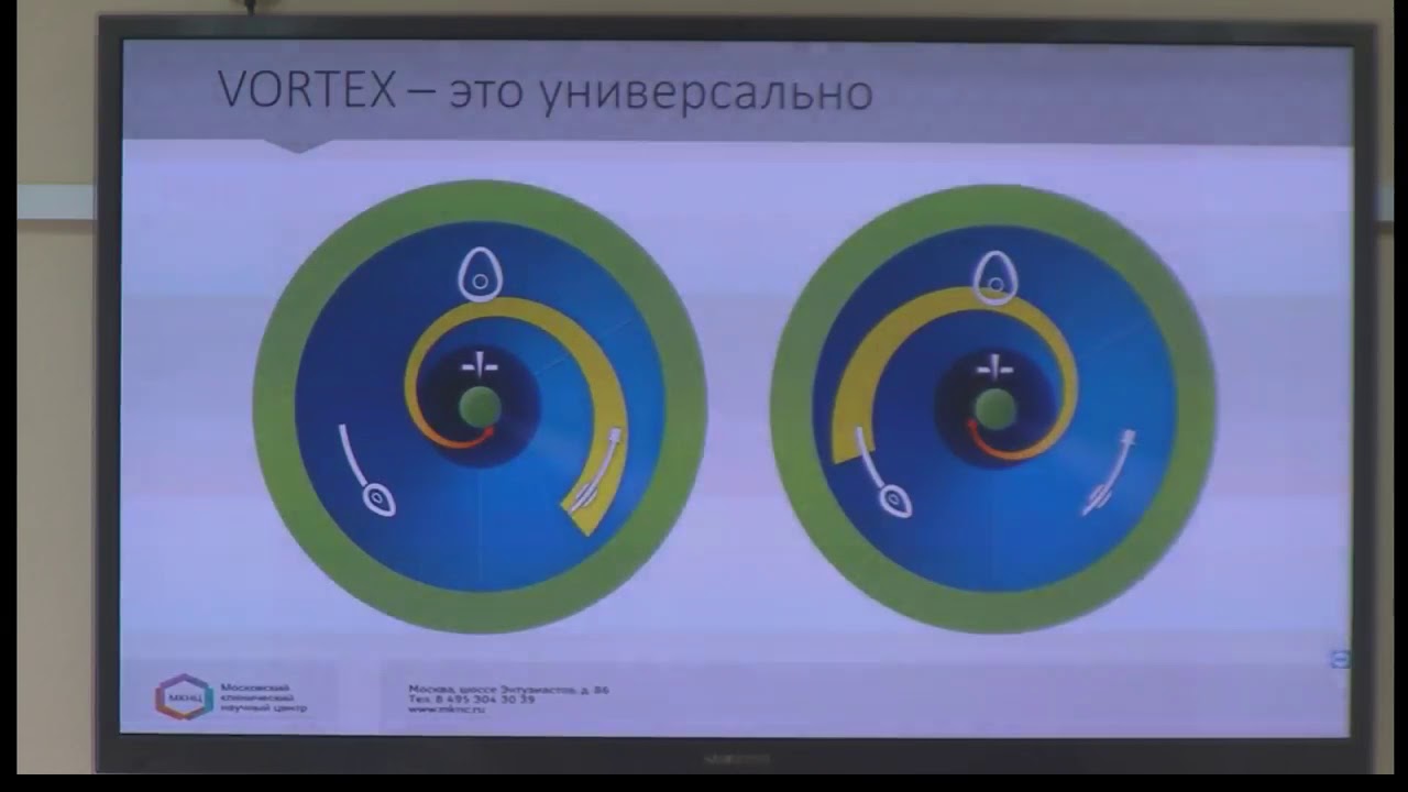 Воронка времени vortex Воронка времени vortex