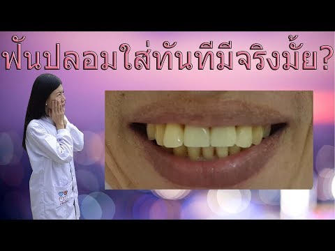ฟันปลอมใส่ทันทีมีจริงมั้ย