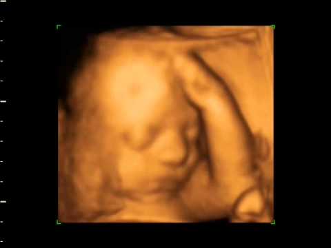 window to the womb bexleyheath 25wks 4D Ultrasound baby scan. Window to the Womb Ltd
