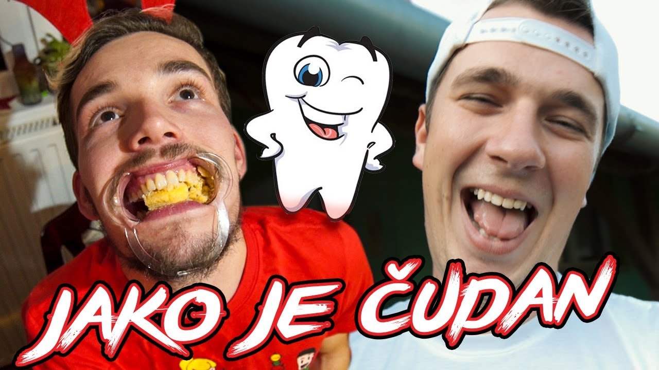DENTAL MOUTH OPENER CHALLENGE YouTube