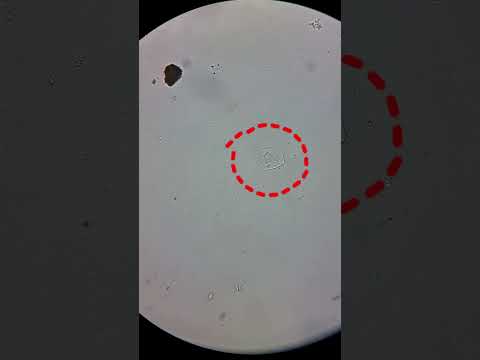 La legendaria coca de piña bajo el microscopio 🍍#shorts #microscopio # ...