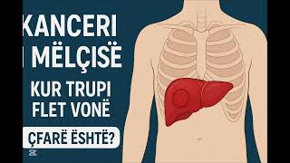 Kanceri I Mëlçisë Kur Trupi Flet Vonë.