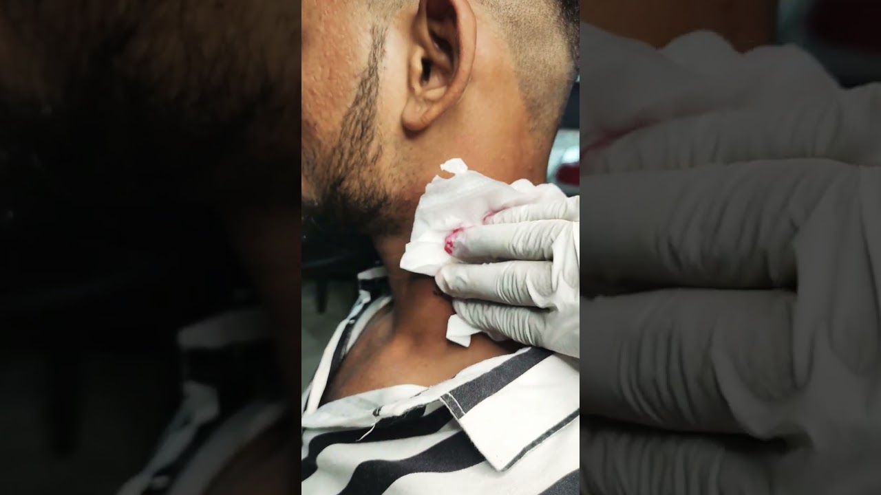 💋💋💋 kiss me 