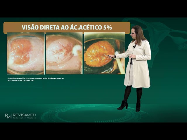 Super dica para a prova de Ginecologia/biópsia - Residência Médica