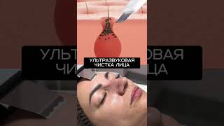 Ультразвуковая чистка лица 💆♀️
