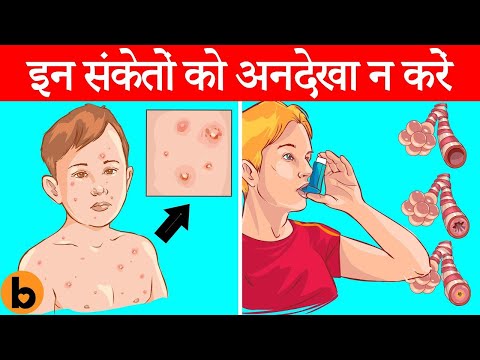 बच्चों के यह स्वास्थ्य लक्षण जिसे नज़र अंदाज़ ना करें | Never Ignore These Health Symptoms In Children