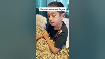 MY SON HAS 11 FINGERS!!