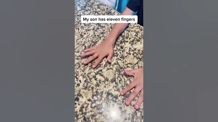 MY SON HAS 11 FINGERS!! - DayDayNews