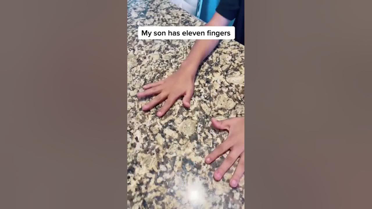 MY SON HAS 11 FINGERS!!