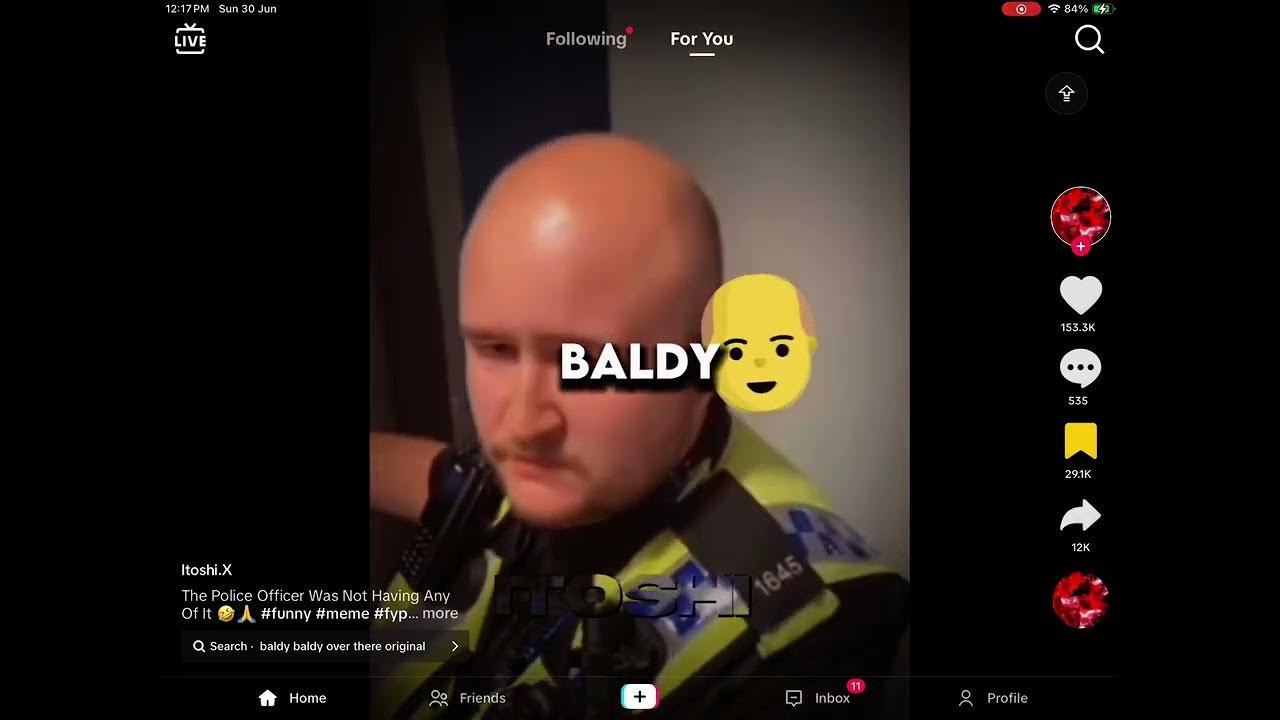 Baldy baldy over there what’s it like to have no hair😂 YouTube