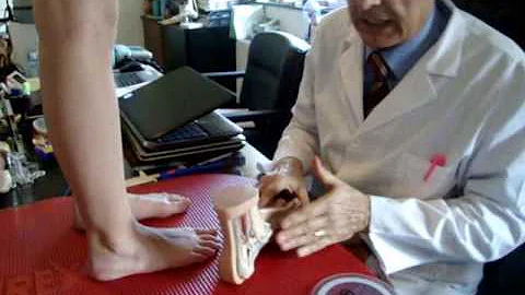 Quali sono le conseguenze del piede piatto?