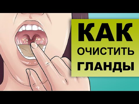 КАК ПРОМЫВАТЬ ГЛАНДЫ