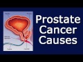 Prostate Cancer Causes