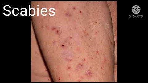 Std : 5.Sub: E.V.S 1.Ls.no.23. Infectious diseases and how to prevent them