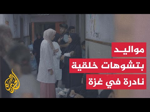 ارتفاع حالات التشوّه الخلقي النادر بين المواليد في غزة
