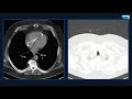 Great Calls! | 15 Minute Radiology CME